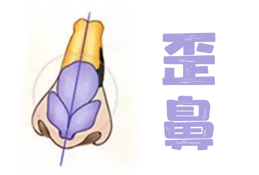 圖文圖片