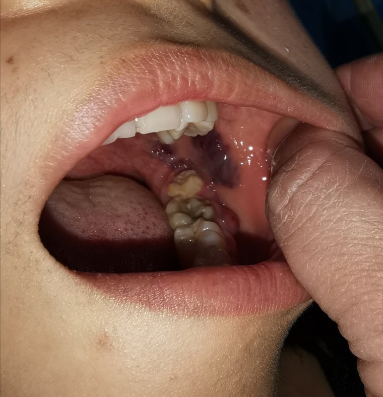 圖片