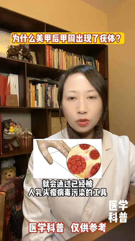 視頻封面