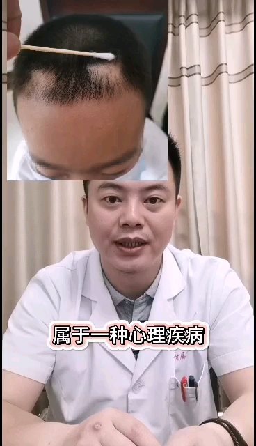 拔毛癖是怎么回事？