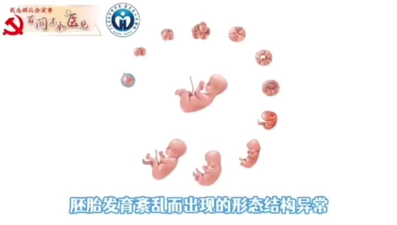 医学科普——宝宝脖子有“鼓包”或“小孔”，警惕鳃裂畸形