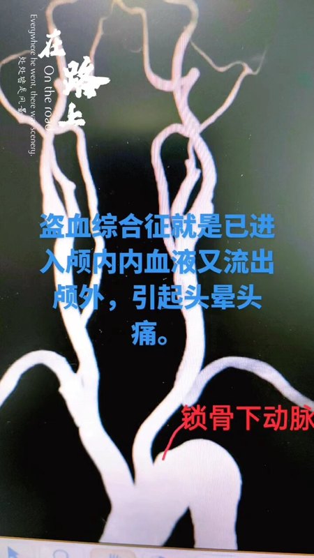 視頻封面