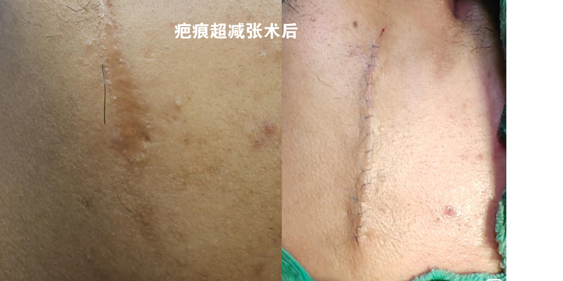 圖文圖片