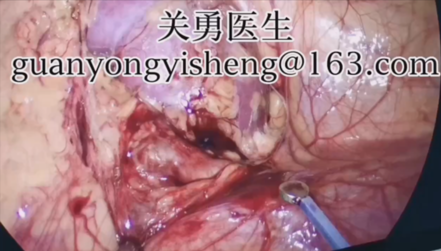 圖文圖片