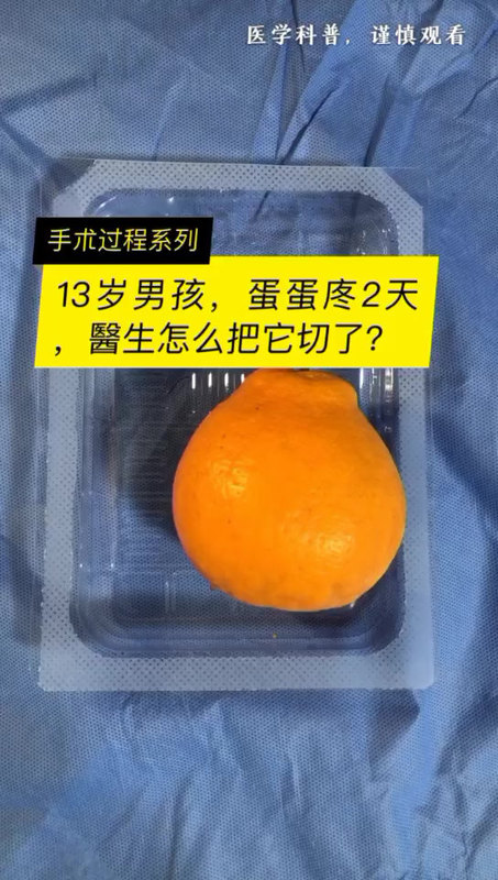 視頻封面