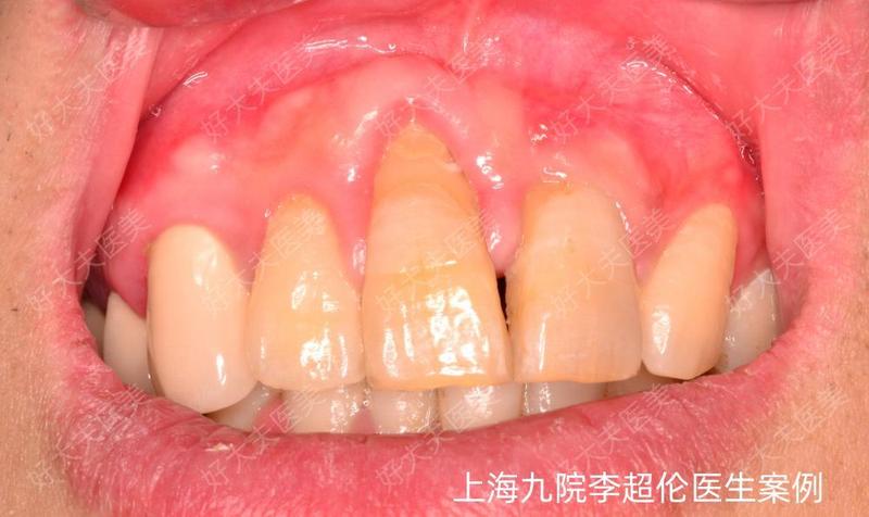 圖文圖片
