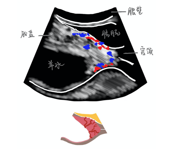 圖文圖片
