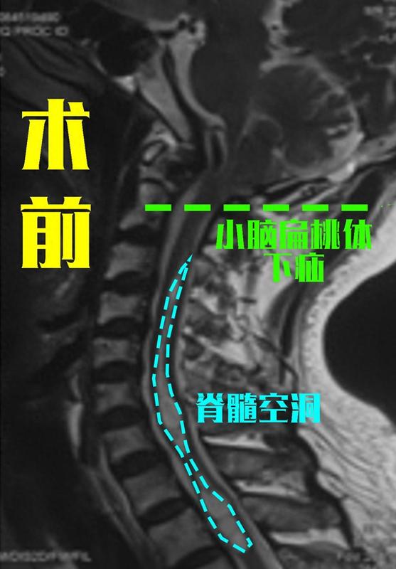 圖文圖片