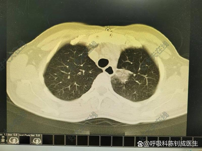 圖文圖片
