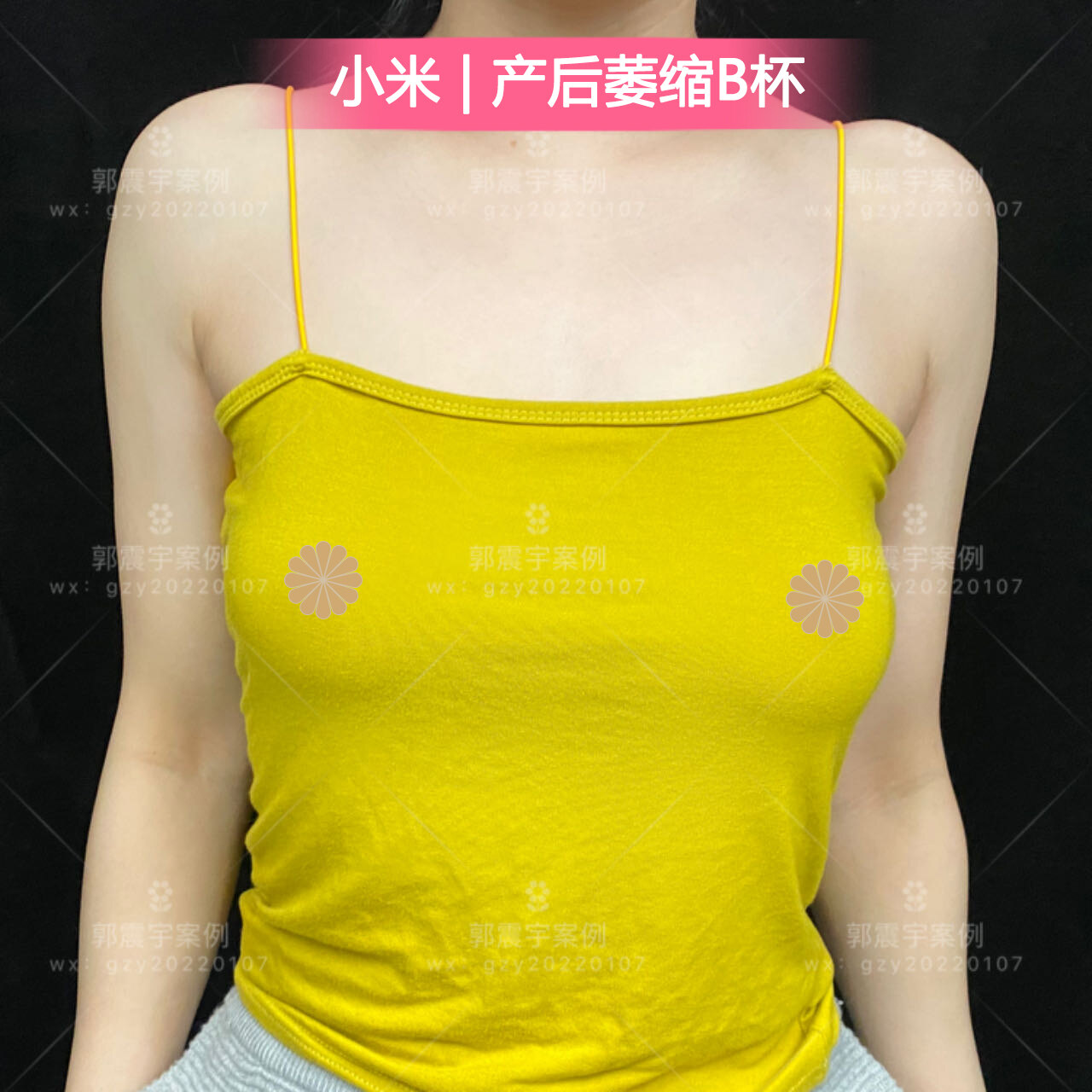 圖文圖片