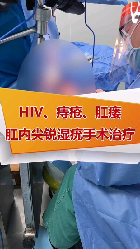合并HIV感染的肛内尖锐湿疣，痔疮，肛瘘病情手术