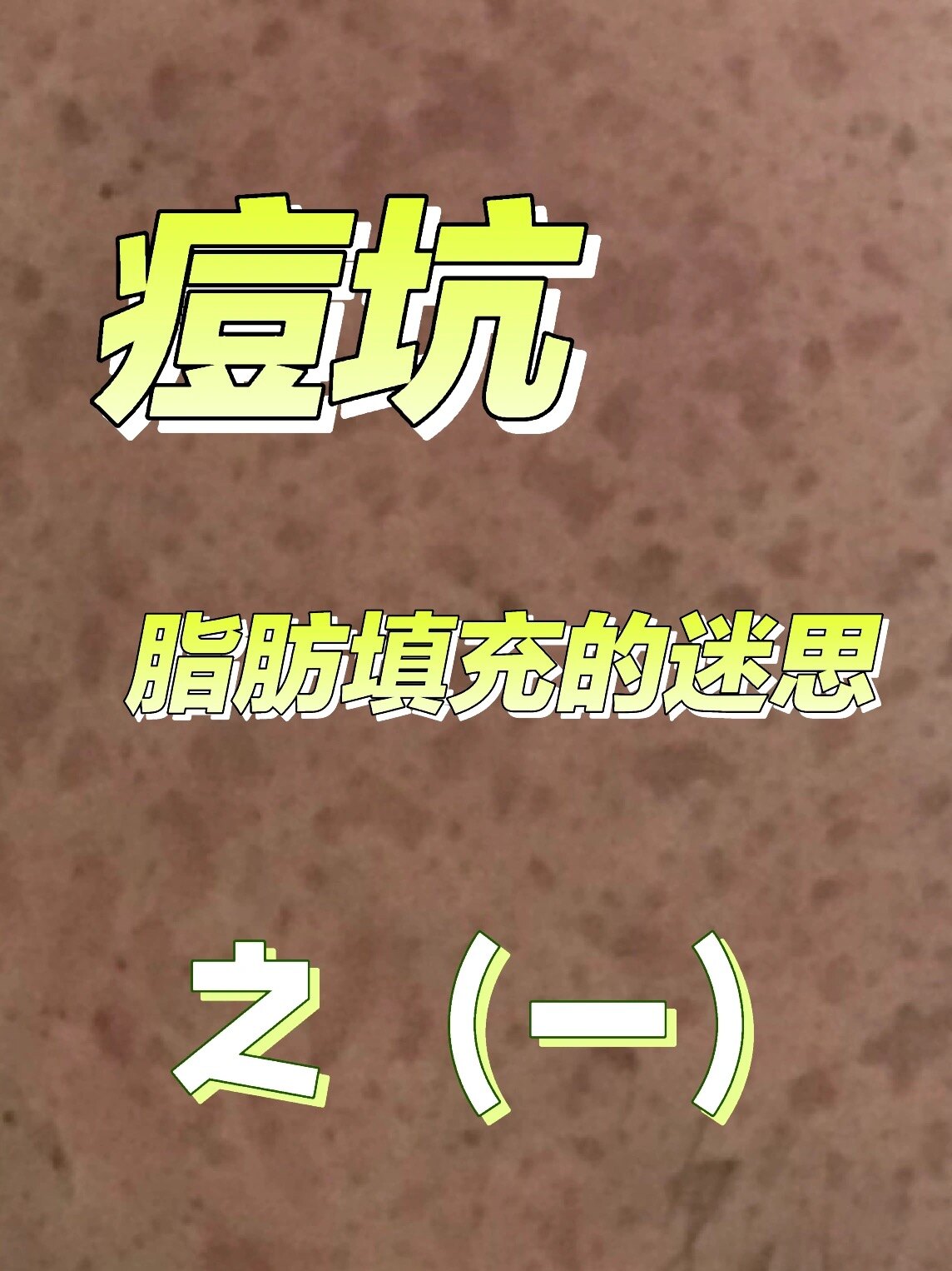 圖文圖片