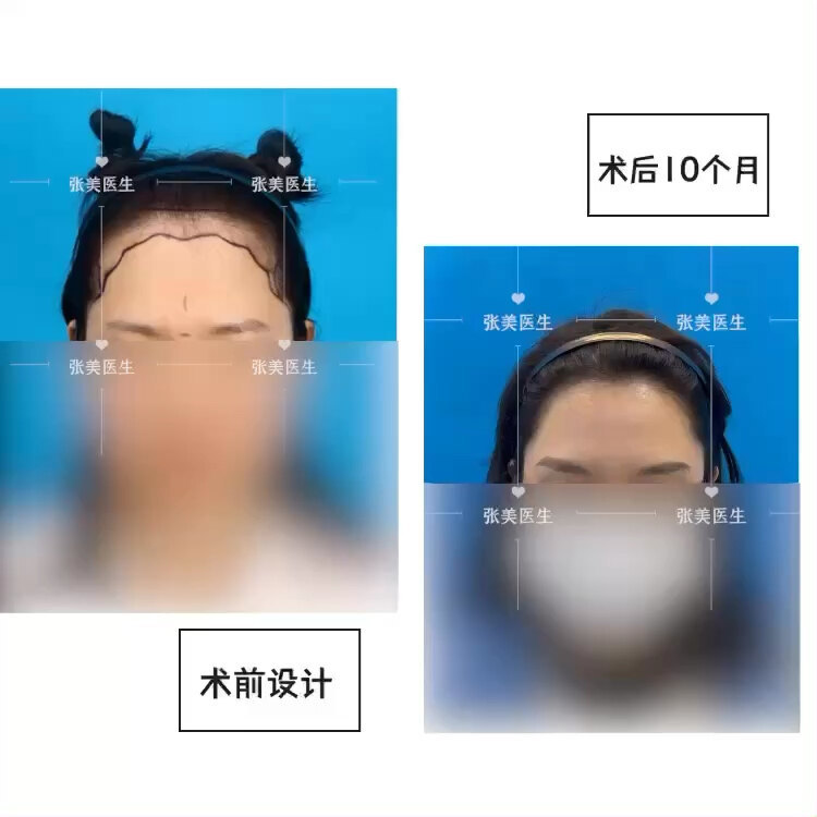 視頻封面