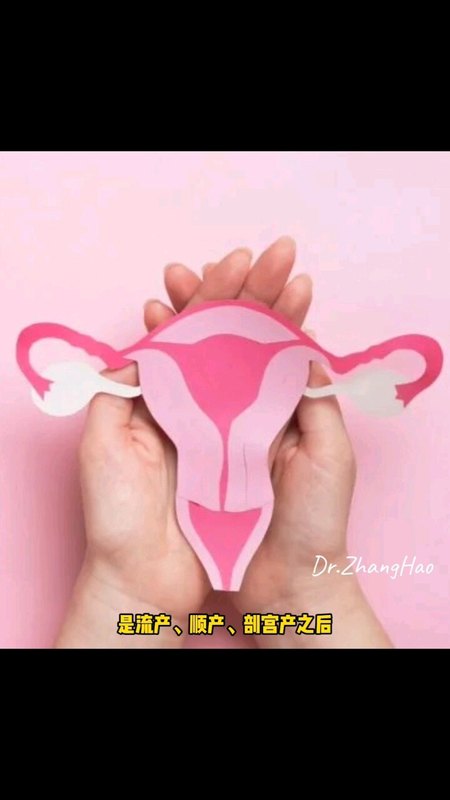 胚物残留，动静脉瘘，莫要慌
