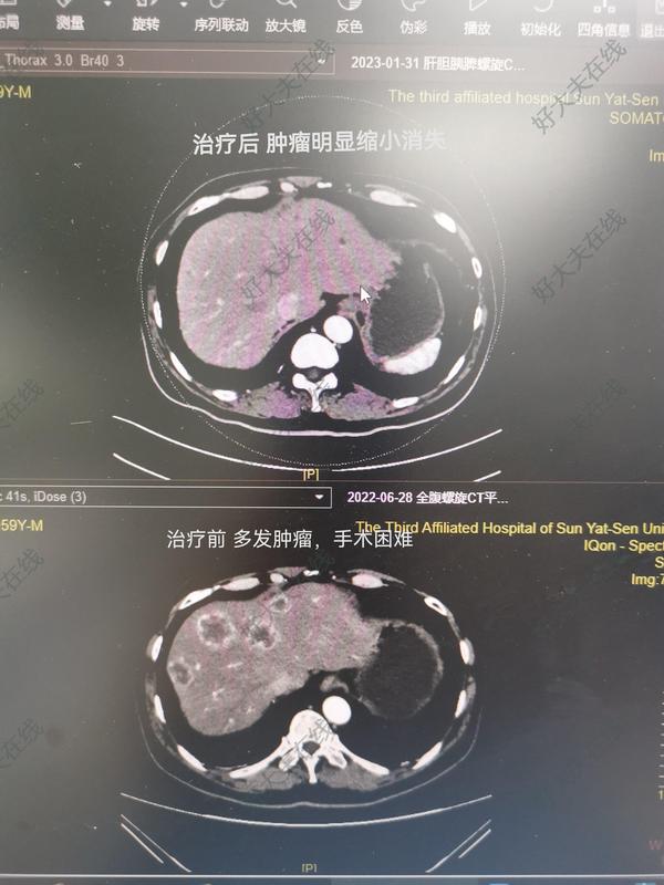 圖文圖片