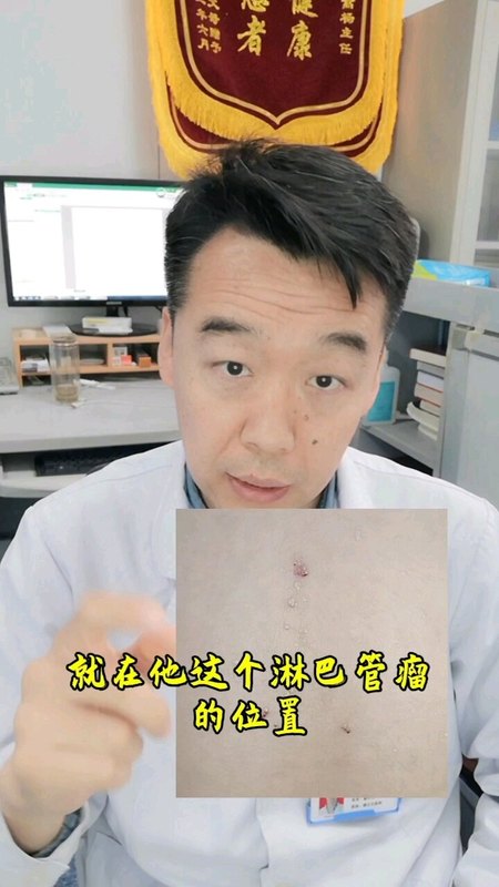 淋巴管瘤＆病毒疣