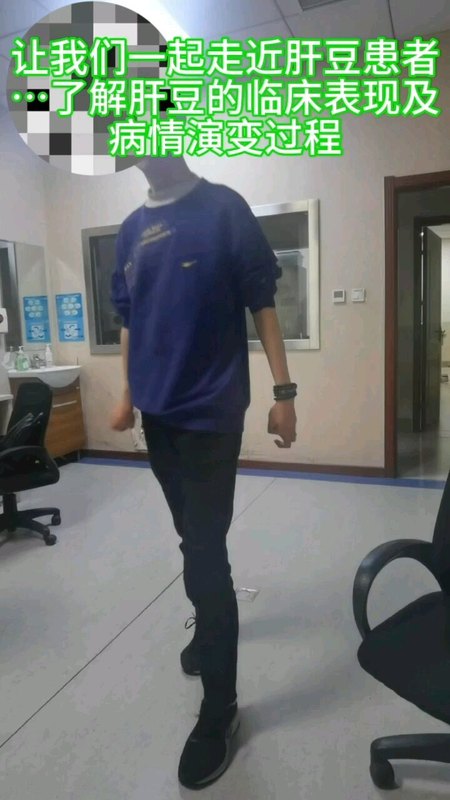 让我们一起走近肝豆患者
                    …了解肝豆的临床表现及
                    病情演变过程AAA