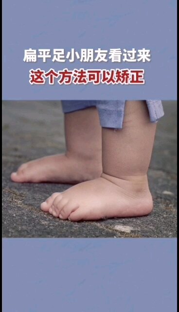 学会两个动作矫正孩子扁平足，预防足外翻！