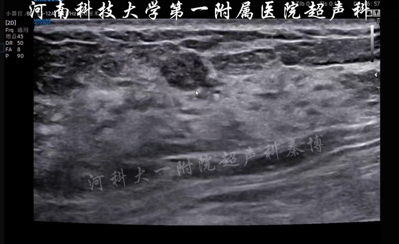 視頻封面