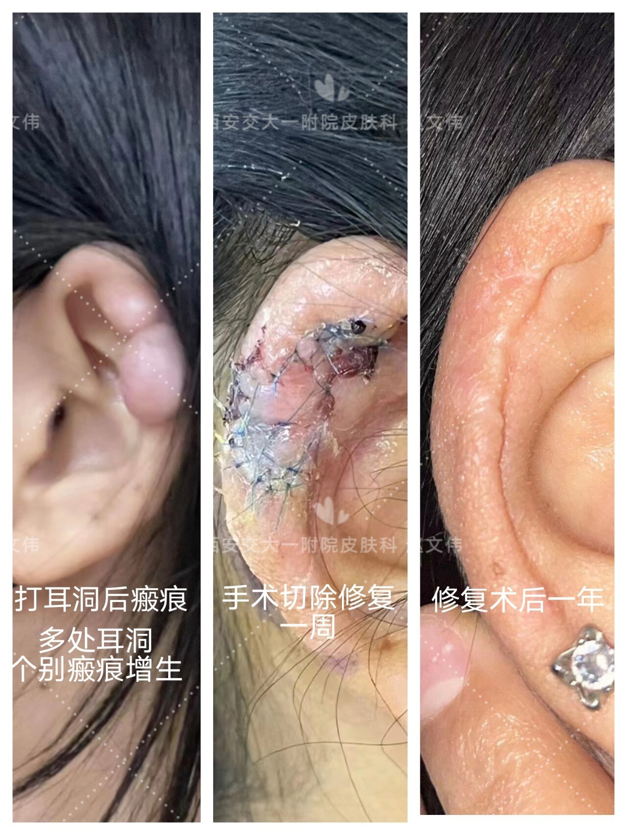 圖文圖片
