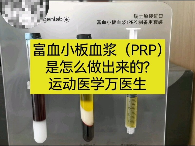 富血小板血浆（PRP）是怎么样做出来的？