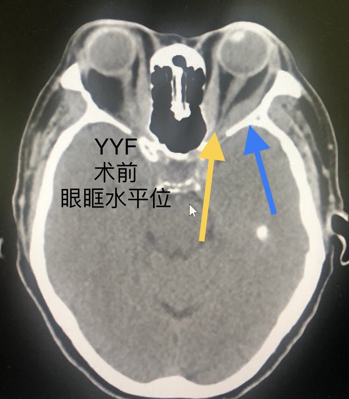 圖文圖片
