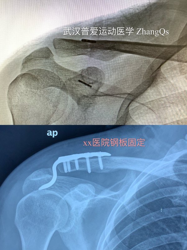 圖文圖片