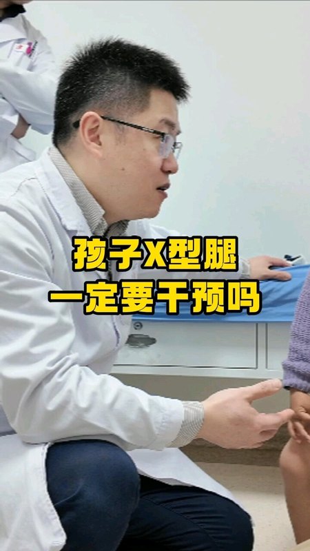 孩子X型腿一定要干预吗？
