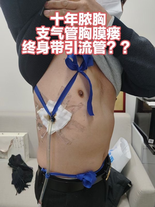 圖文圖片