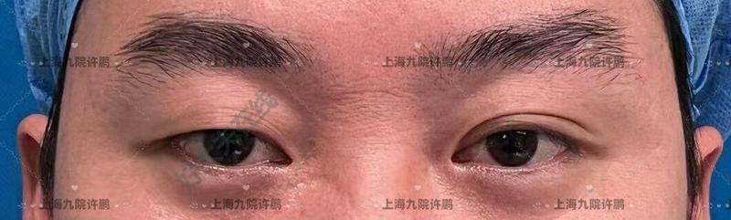 圖文圖片