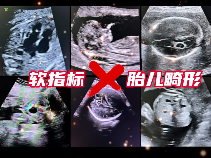 視頻封面