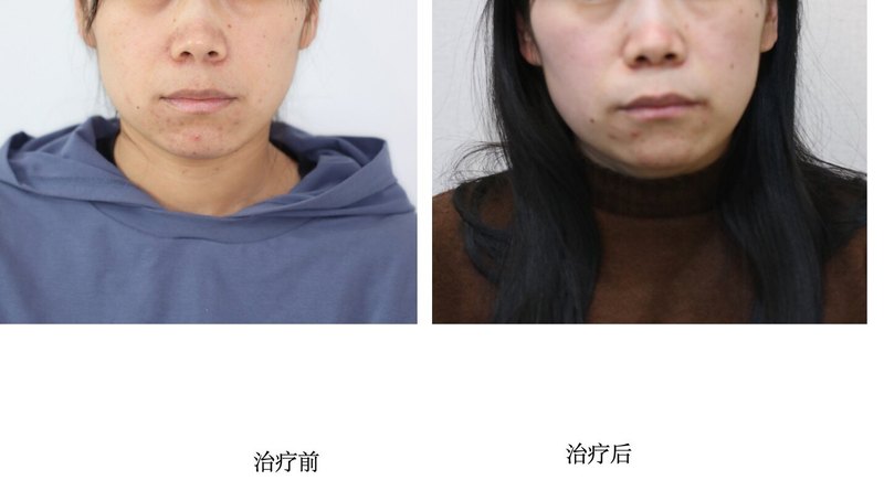 圖文圖片