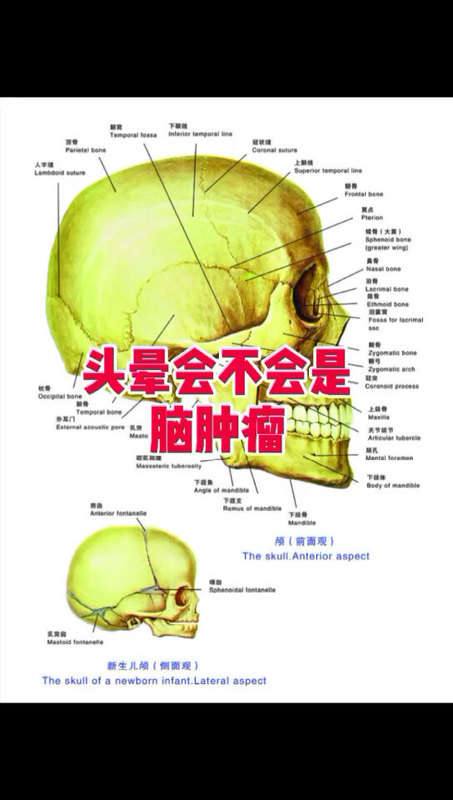 头晕会不会是脑肿瘤