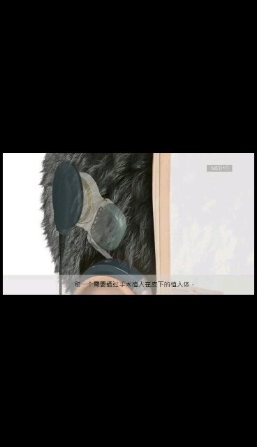 人工耳蜗是如何让听障人听到声音的呢？