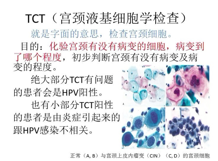 宫颈TCT检查是查什么？