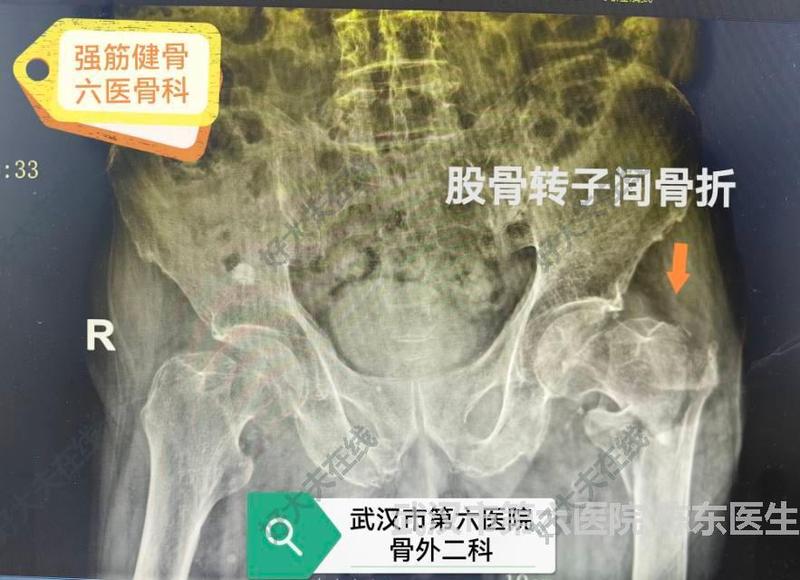 圖文圖片
