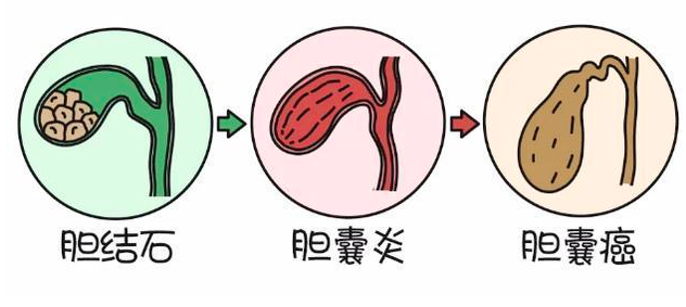 圖文圖片