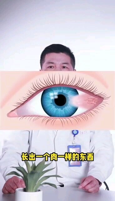 肉肉长到眼白上了怎么办？