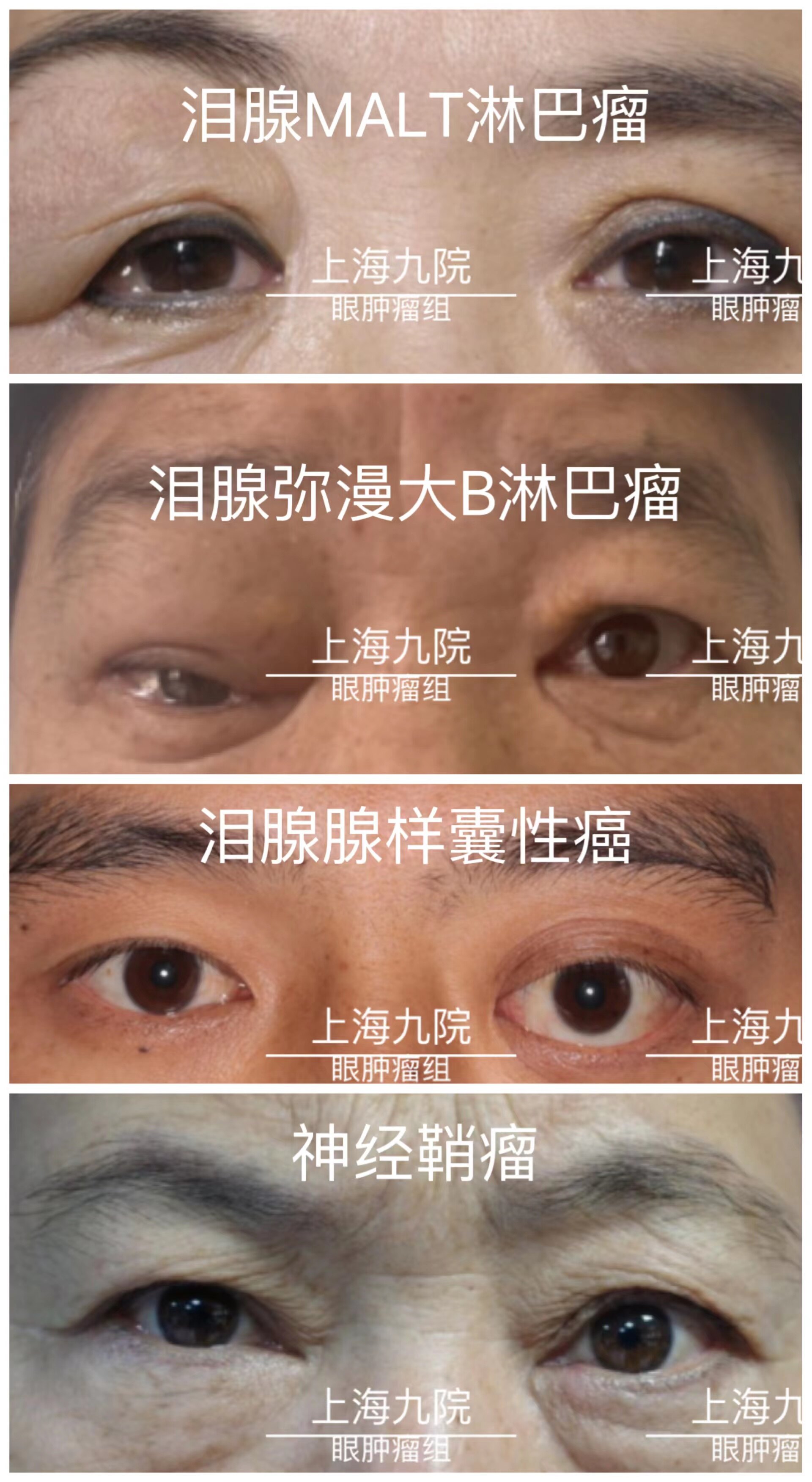 圖文圖片