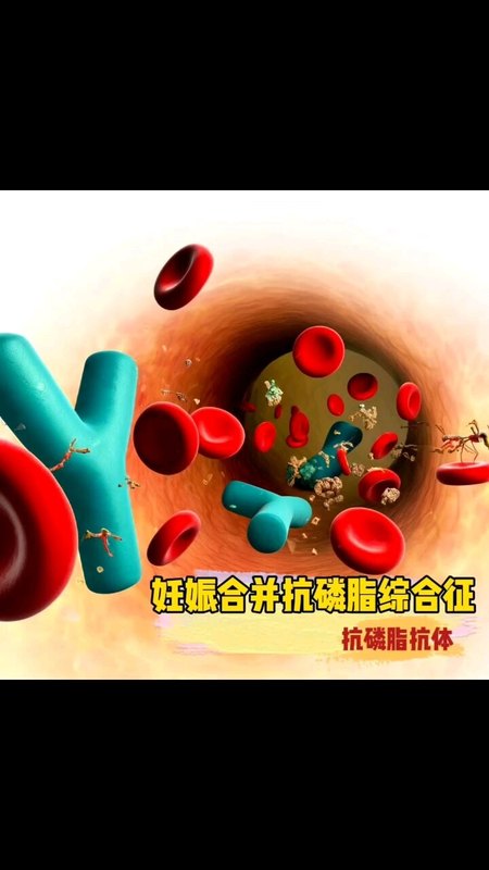 視頻封面