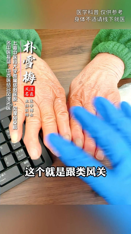 退化性关节炎表现