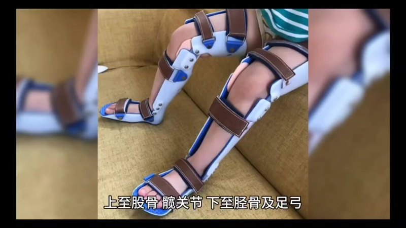 什么是儿童O型腿？儿童发生O型腿会有哪些危害？
