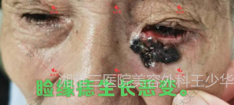 圖文圖片