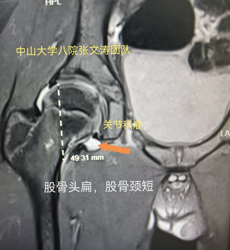 圖文圖片