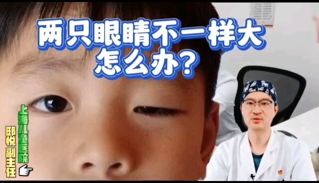 两只眼睛不一样大怎么办？