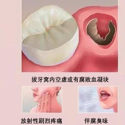 圖文圖片