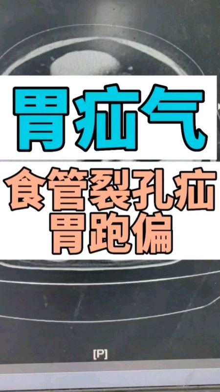 食管裂孔疝图像
