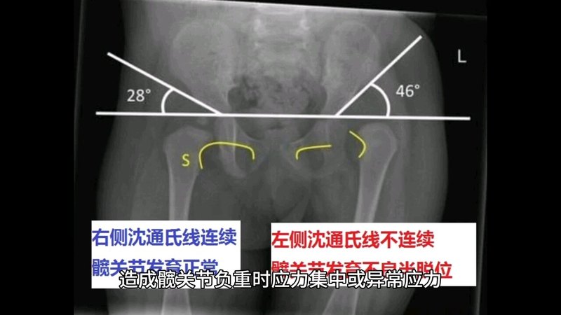視頻封面