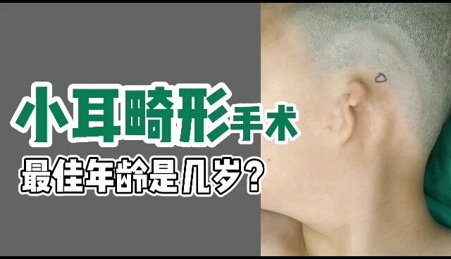 耳朵畸形不一定要做手术，千万别错过这个无创矫正期