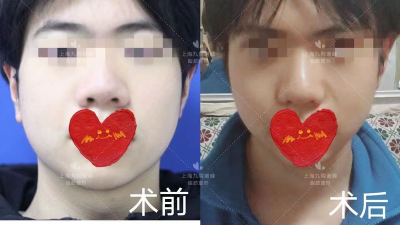 圖文圖片